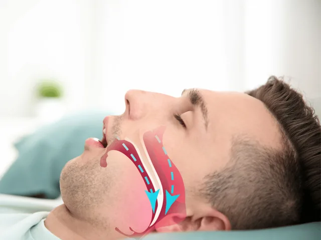 What is sleep apnea?